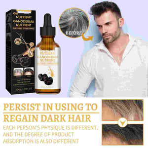 Hair Renew.
Color classification: 30ml (for export sales only, domestic sales are prohibited, purchase is equivalent to default disclaimer).