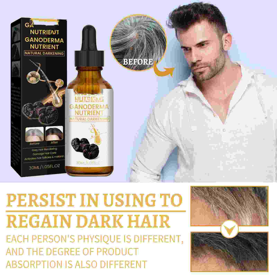 Hair Renew.
Color classification: 30ml (for export sales only, domestic sales are prohibited, purchase is equivalent to default disclaimer).